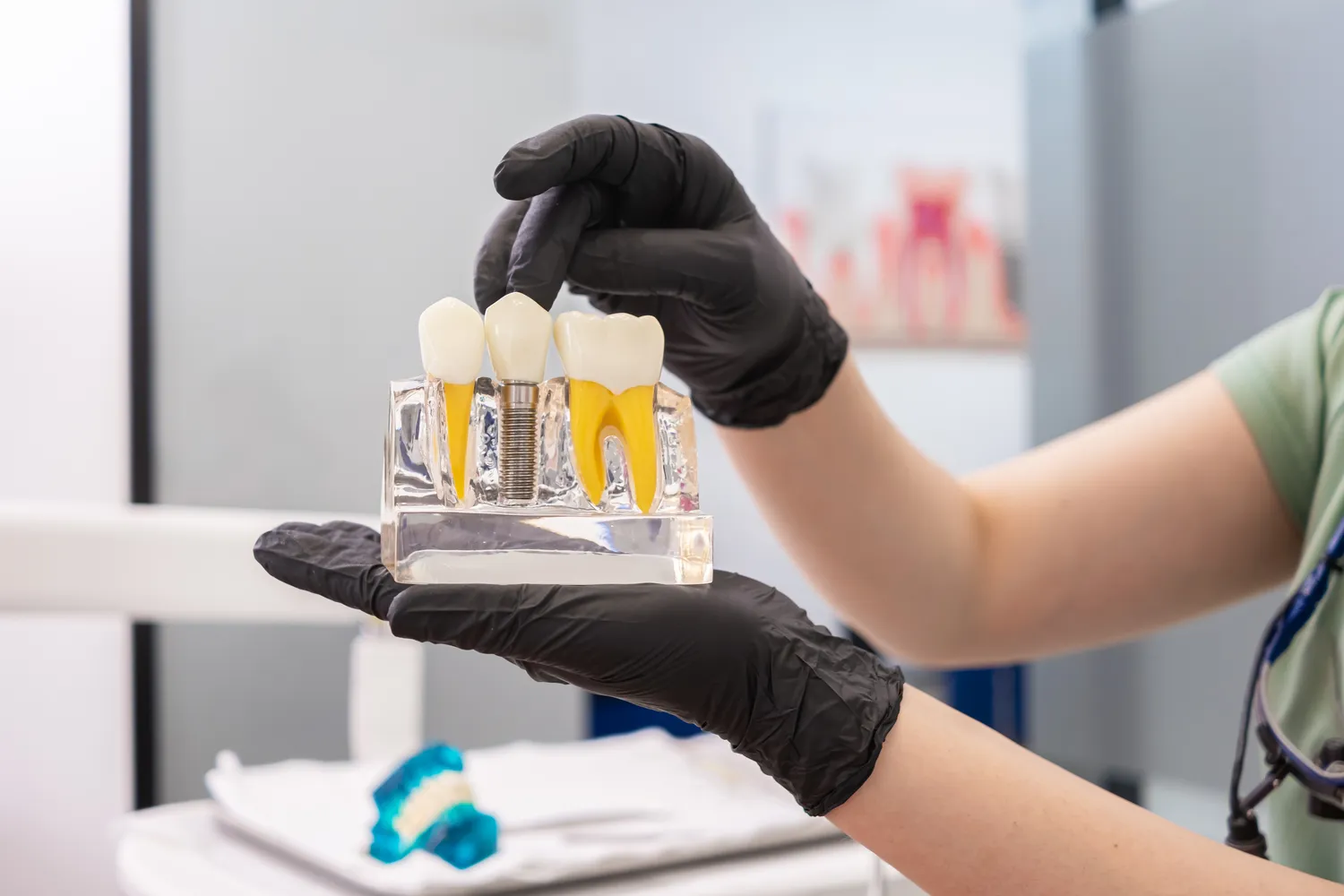 Gdzie najtaniej implanty zębów?