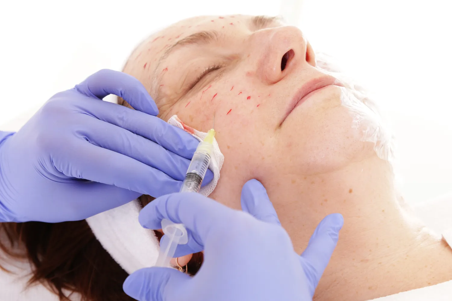 Co na chomiki medycyna estetyczna?