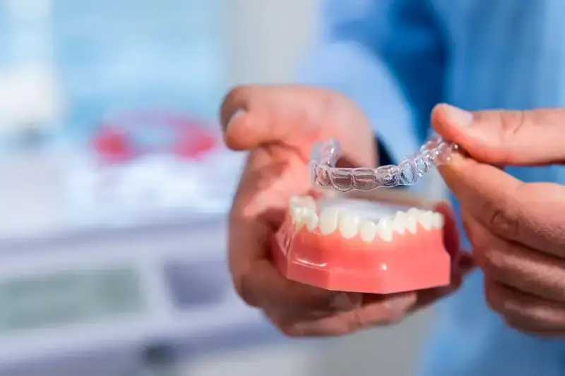 Jak długo trwa leczenie Invisalign?