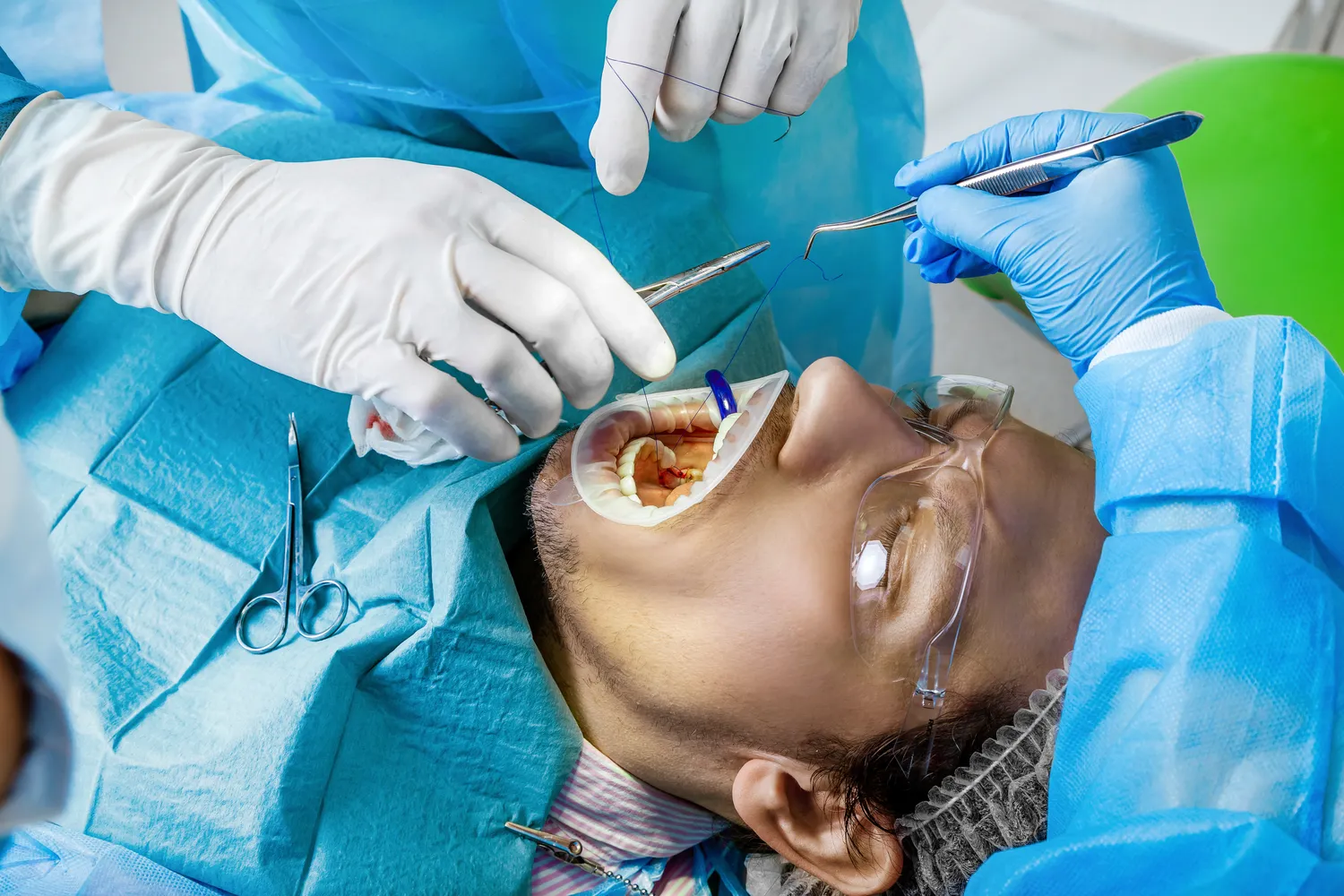 Jakie implanty najlepsze?