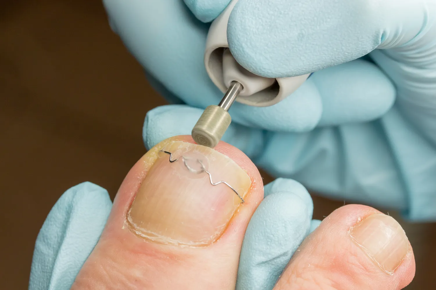 Jak należy poprawnie sterylizować narzędzia w gabinecie podologicznym?