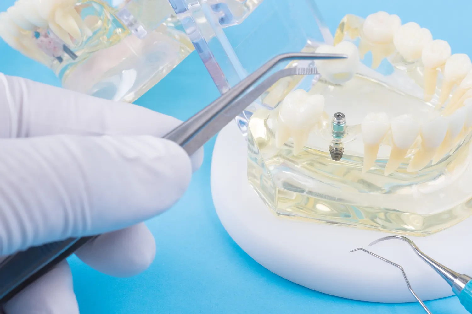 Najlepszy gabinet stomatologiczny Warszawa