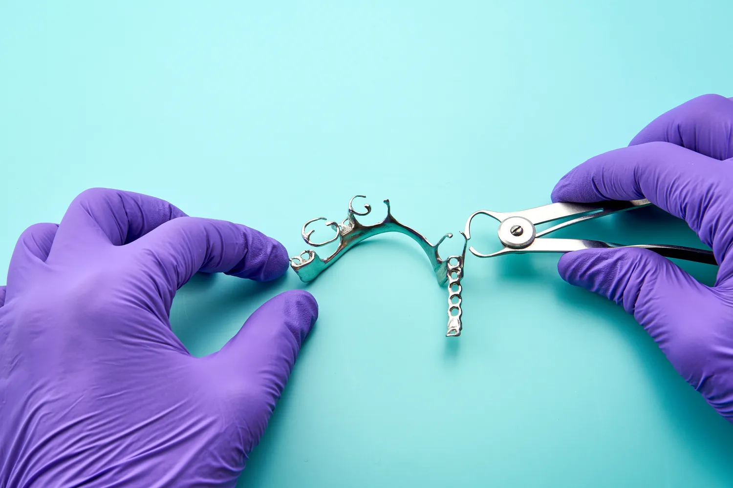 Leczenie kanałowe jak wygląda?