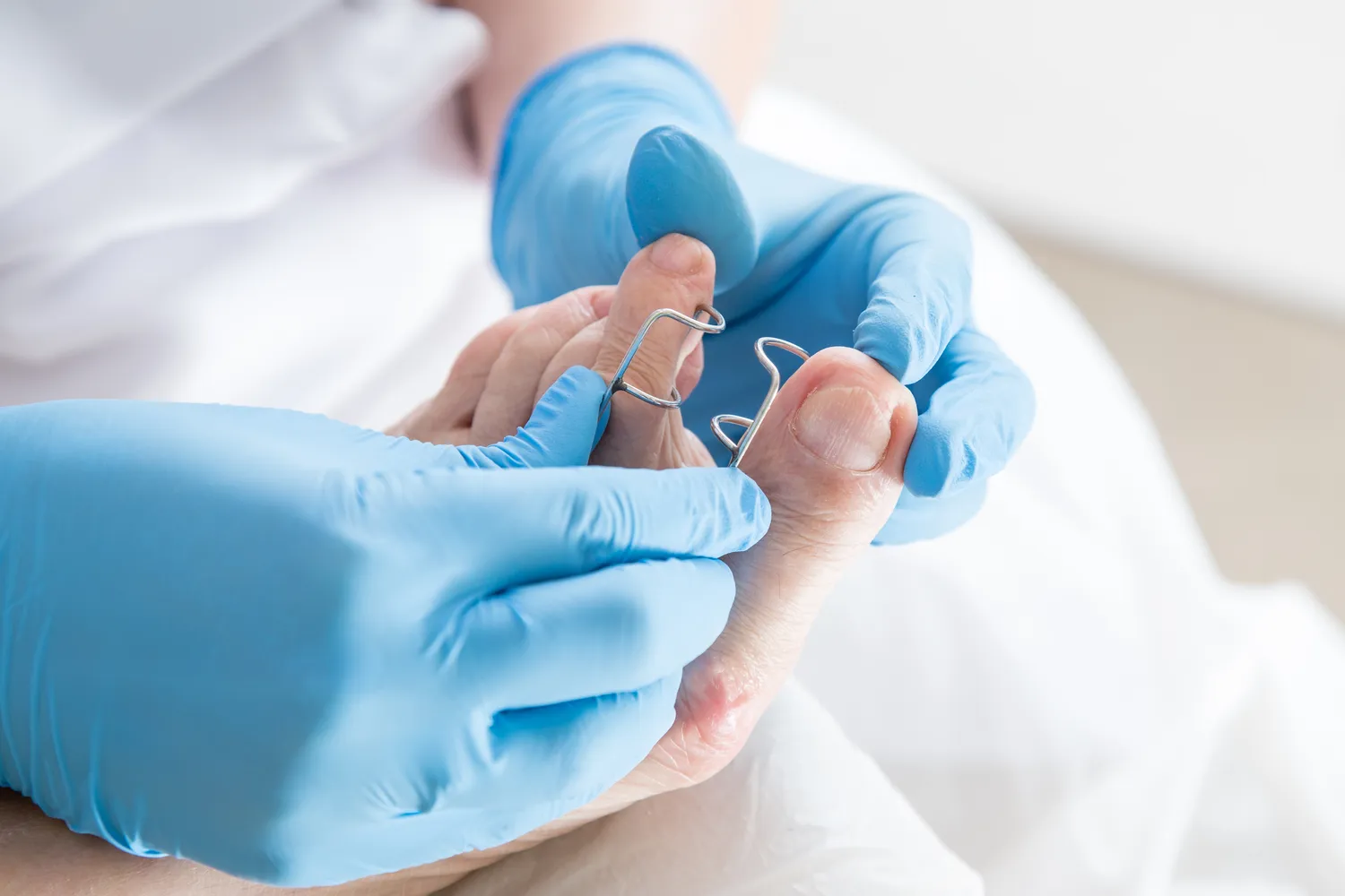  Zachowaj zdrowe stopy - odwiedź podologa